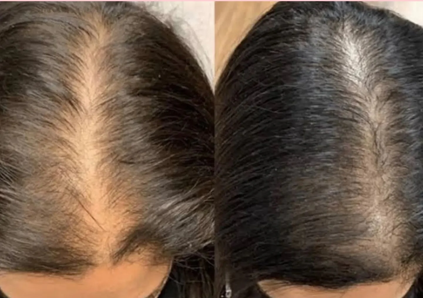 Ancestral Hair Oil - Image 6